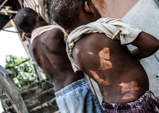 Nigeria under scrutiny after alleged witchcraft accusations lead to humiliation, forced exile and community crackdowns in Ebonyi